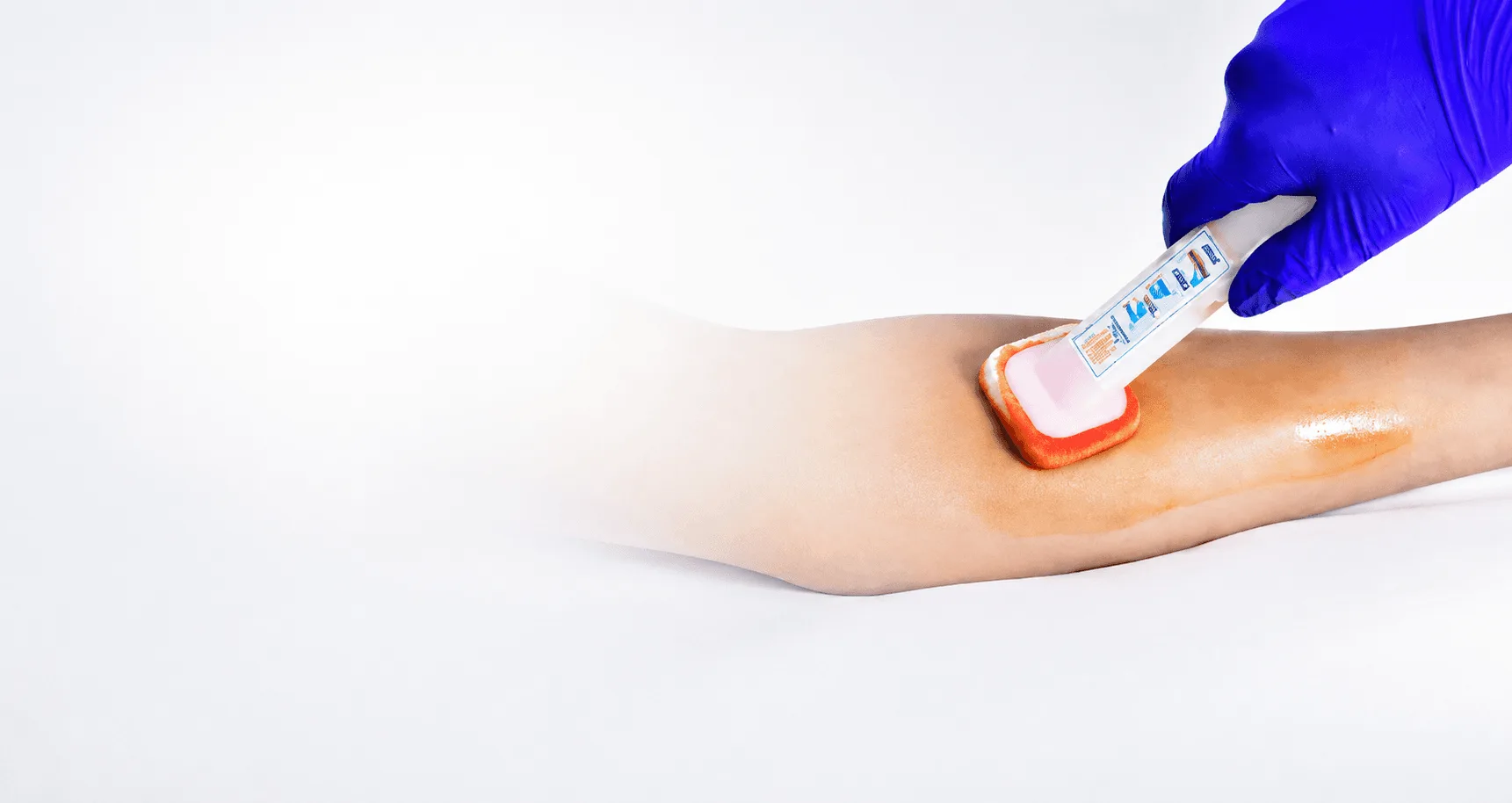 CHG Skin Prep and Surgical Safety Accessories