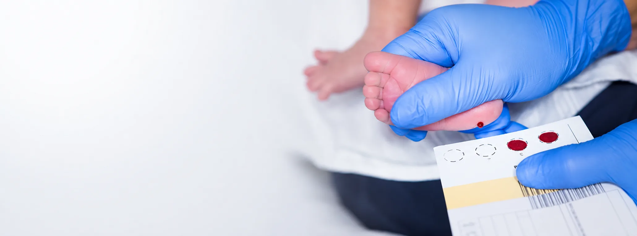 Dried Blood Spot Collection Cards and Diagnostic Solutions