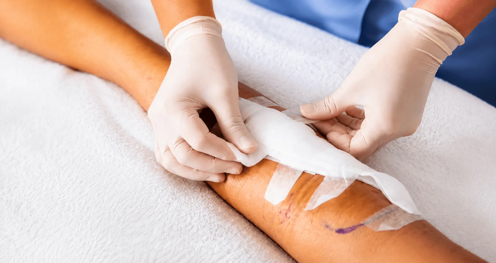 Surgeine Ready to Use Dressing Packs and Surgical Wound Care Kits